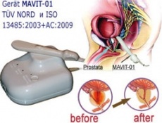 Комплексная терапия простатита с помощью устройства МАВИТ
