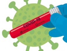 Тесты на коронавирусную инфекцию Covid-19